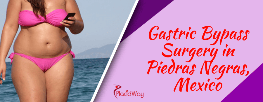 Gastric Bypass Surgery in Piedras Negras, Mexico